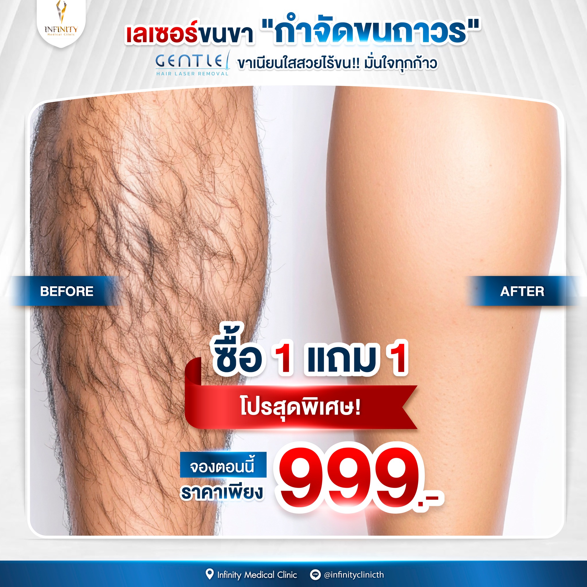 Infinity Medical Clinic TH Facebook ad