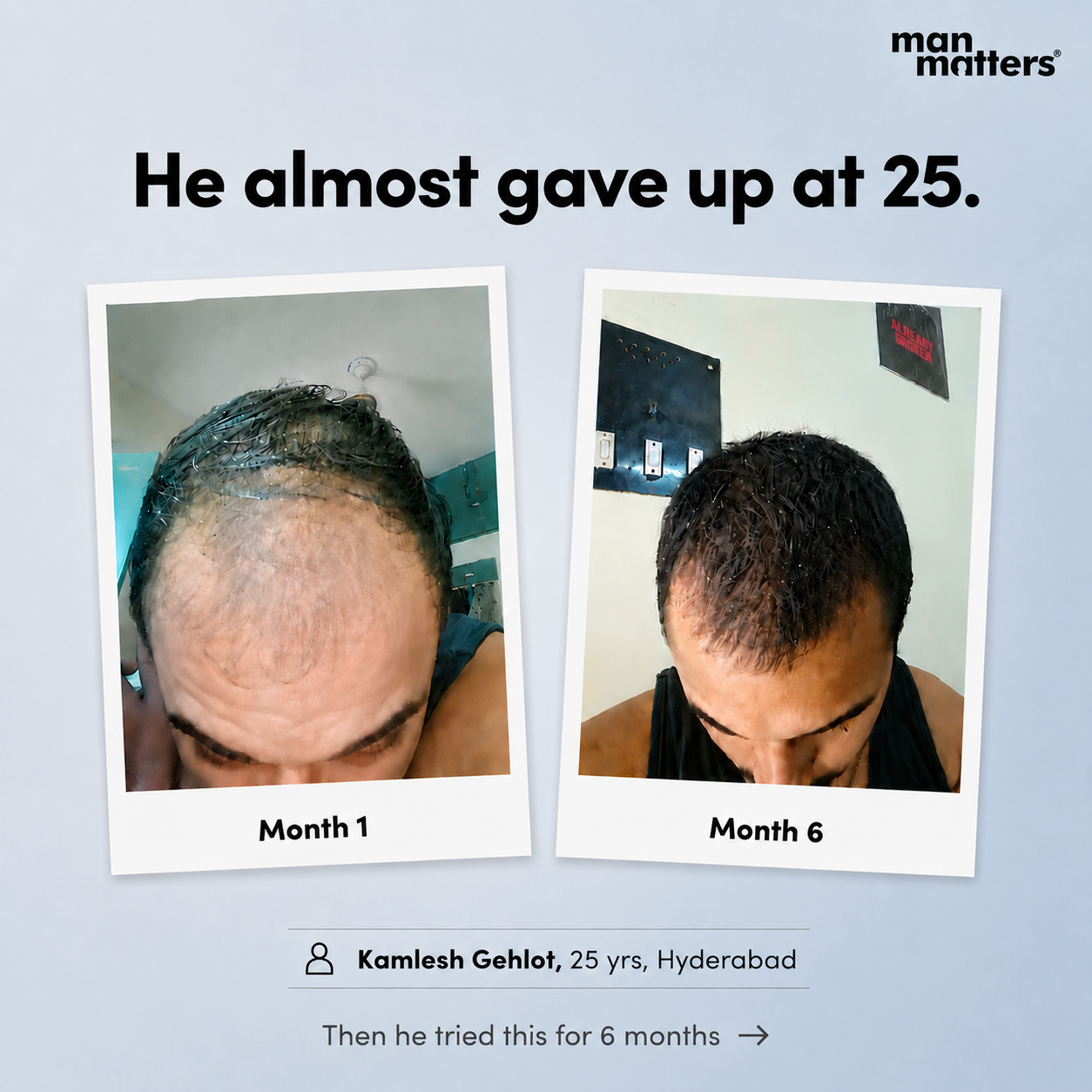 manmattershairwarriors Facebook ad