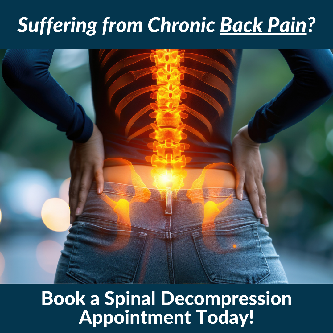 West London Spinal Decompression Facebook ad: $49 Spinal Decompression Consultation + Exam + X-Rays!