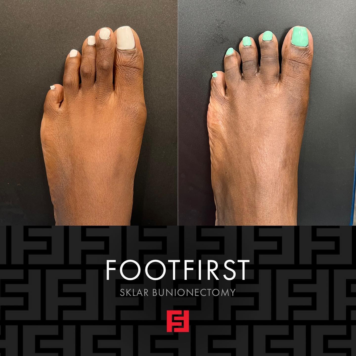 Foot First Podiatry Centers Facebook ad