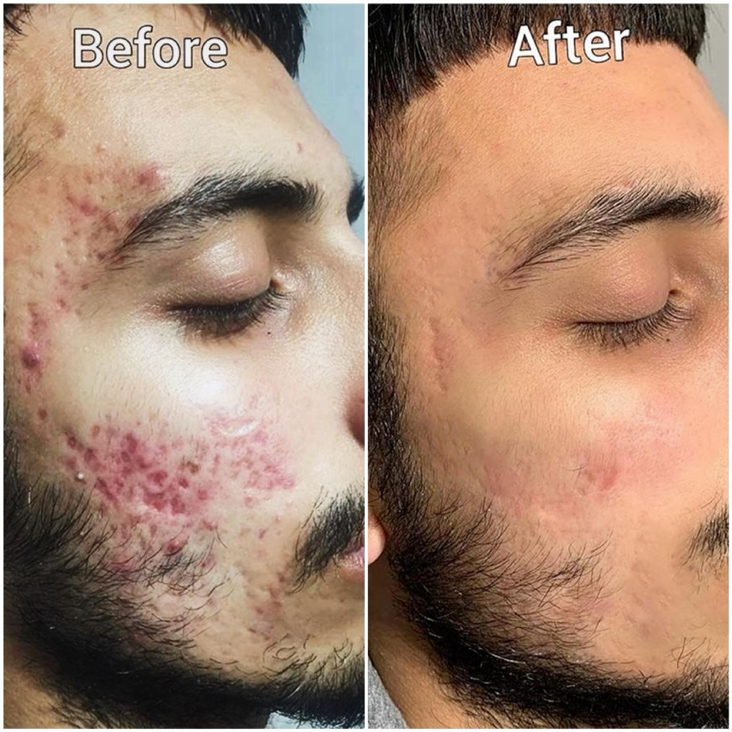 Glow Treatments Facebook ad: Glow treatments Customer result