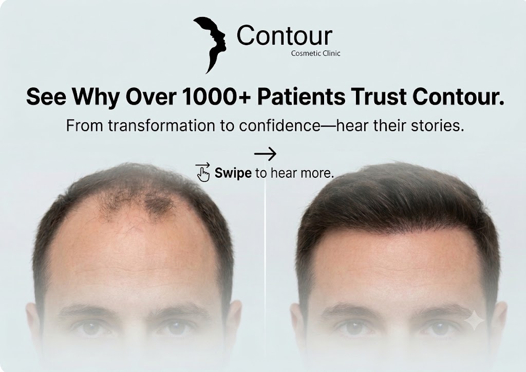 Contour cosmetic clinic Facebook ad