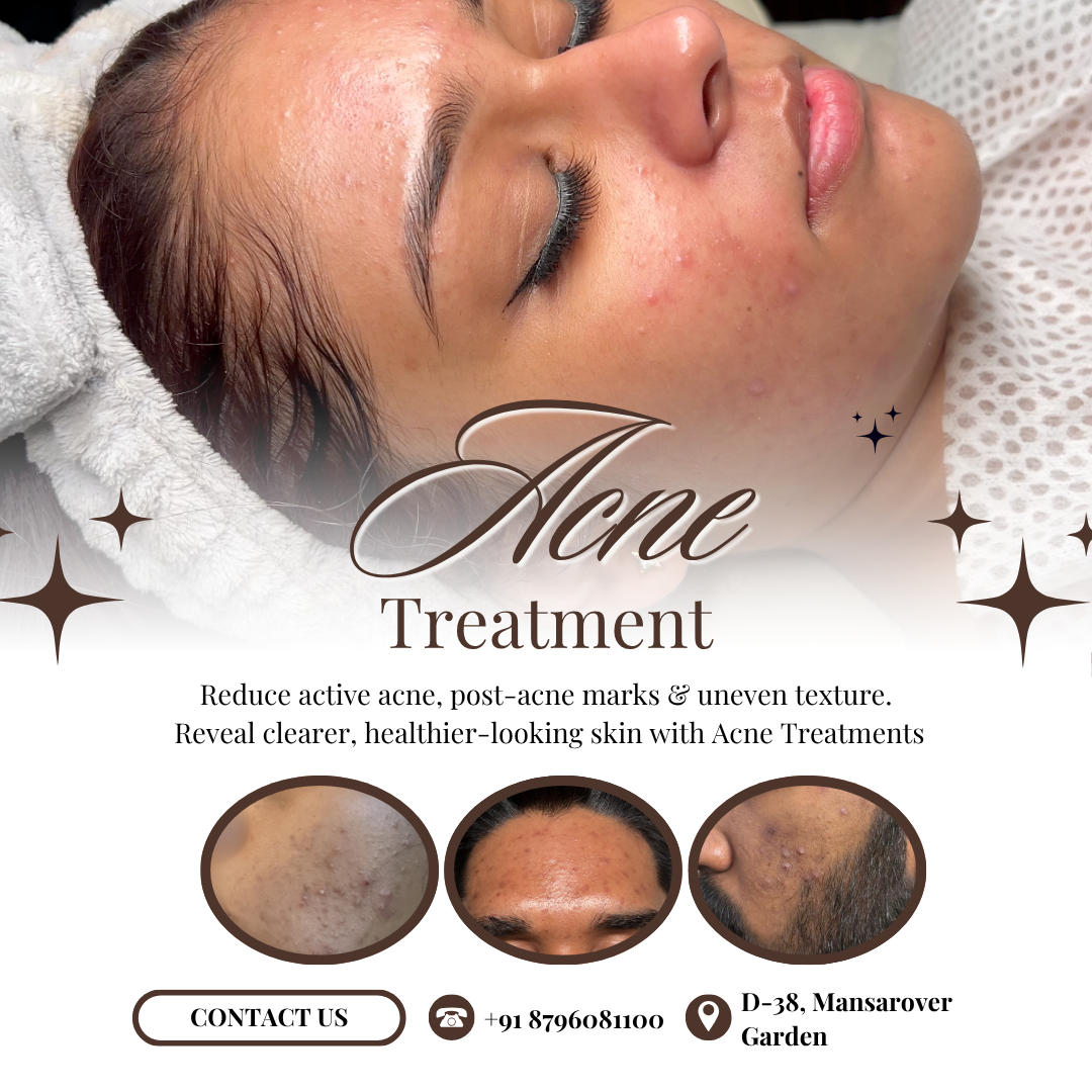 Rae Skin Studio Facebook ad: Are you tired of dealing with constant acne, painful…