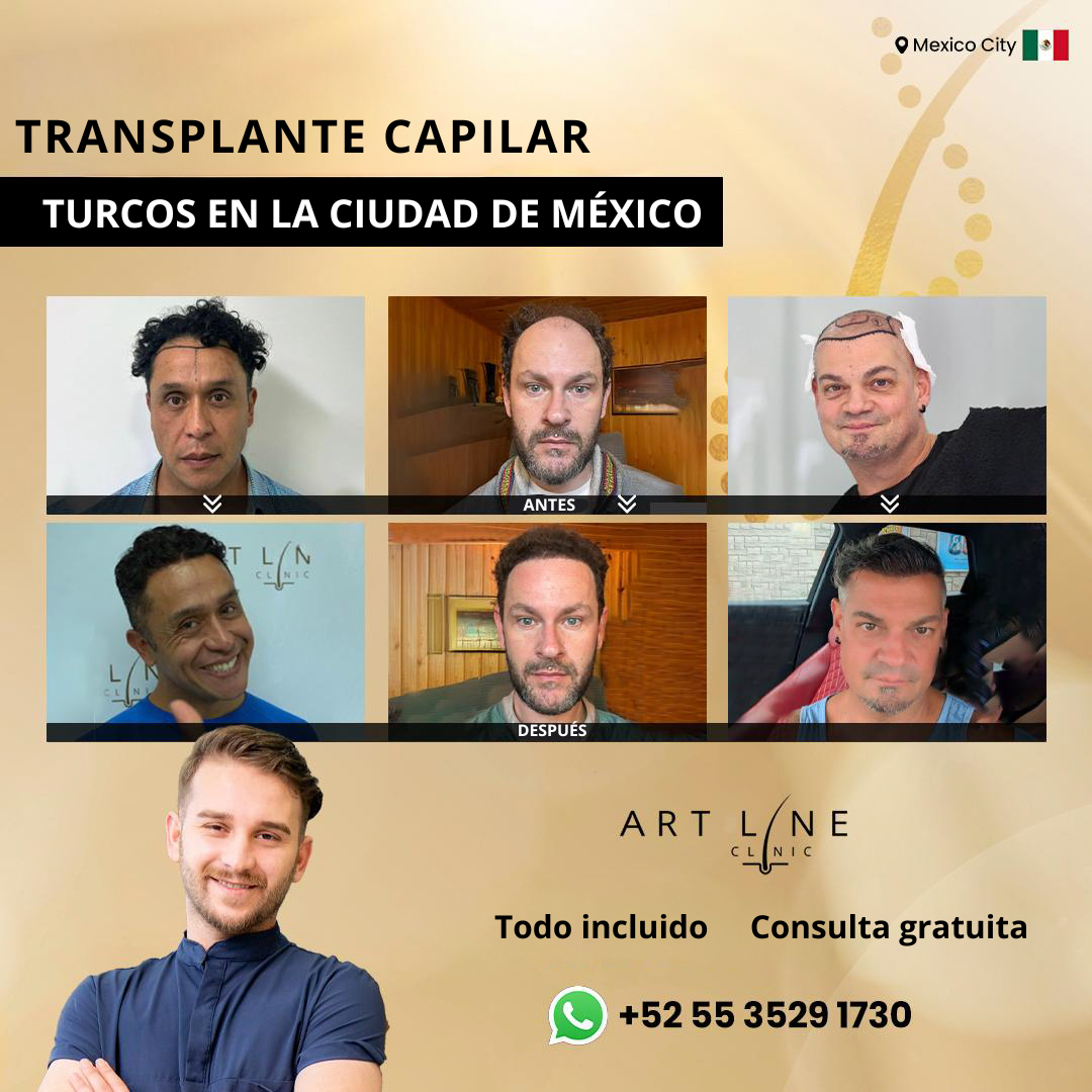 Art Line Hair Clinic CDMX Facebook ad: Agenda tu valoración