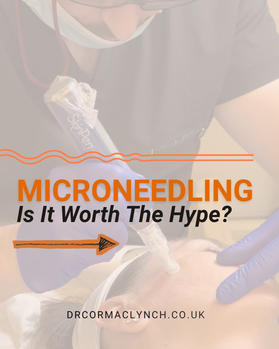 Dr Cormac Lynch Medical Aesthetics Facebook ad: Is microneedling actually worth the hype?