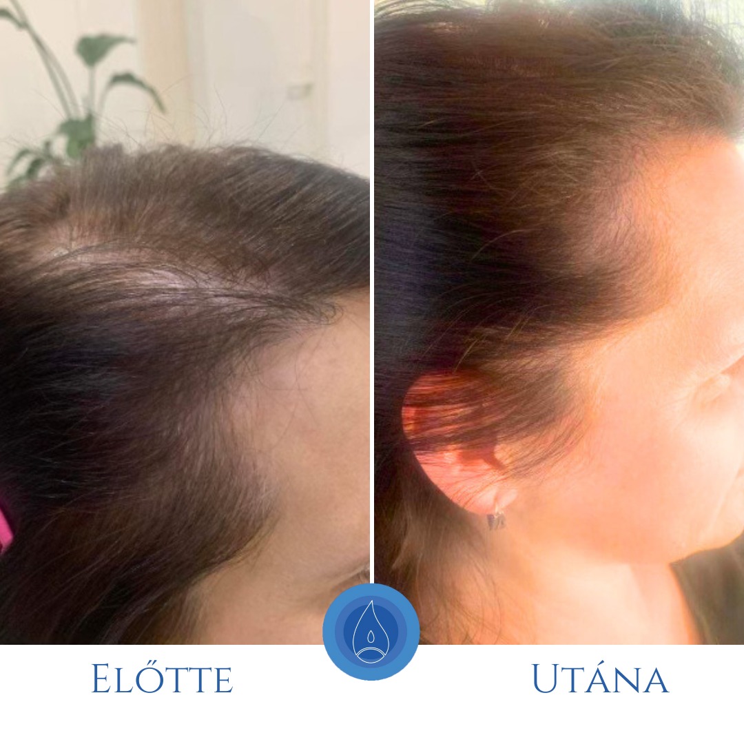 Oxygeni Hair & Skin  Hajgyógyász és Bőrterápia Szalon Mosonmagyaróvár Facebook ad