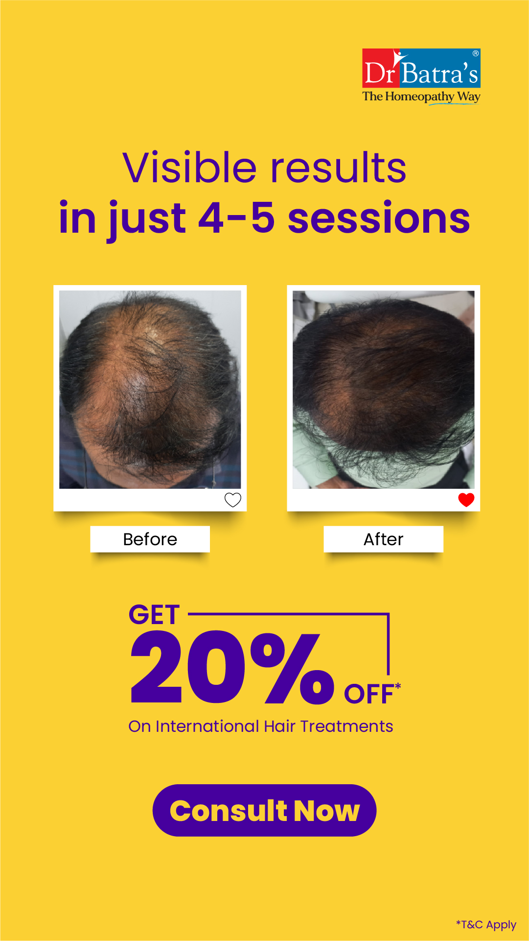 Dr Batra's Facebook ad: Get 20% off hair treatment