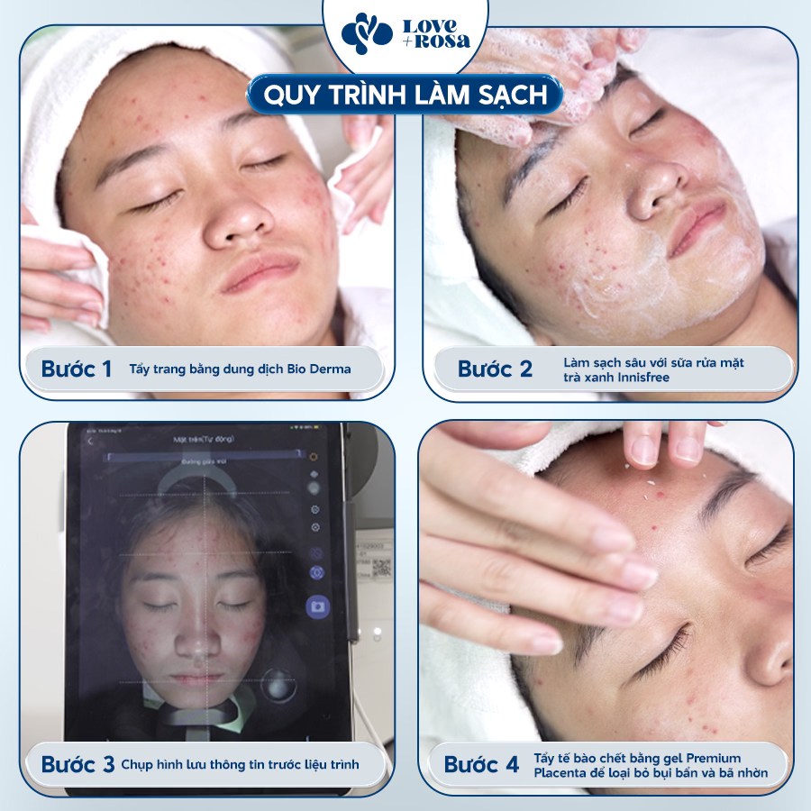 Love + Rosa Skin Center Facebook ad: CON HẾT MỤN - MẸ HẾT LO!