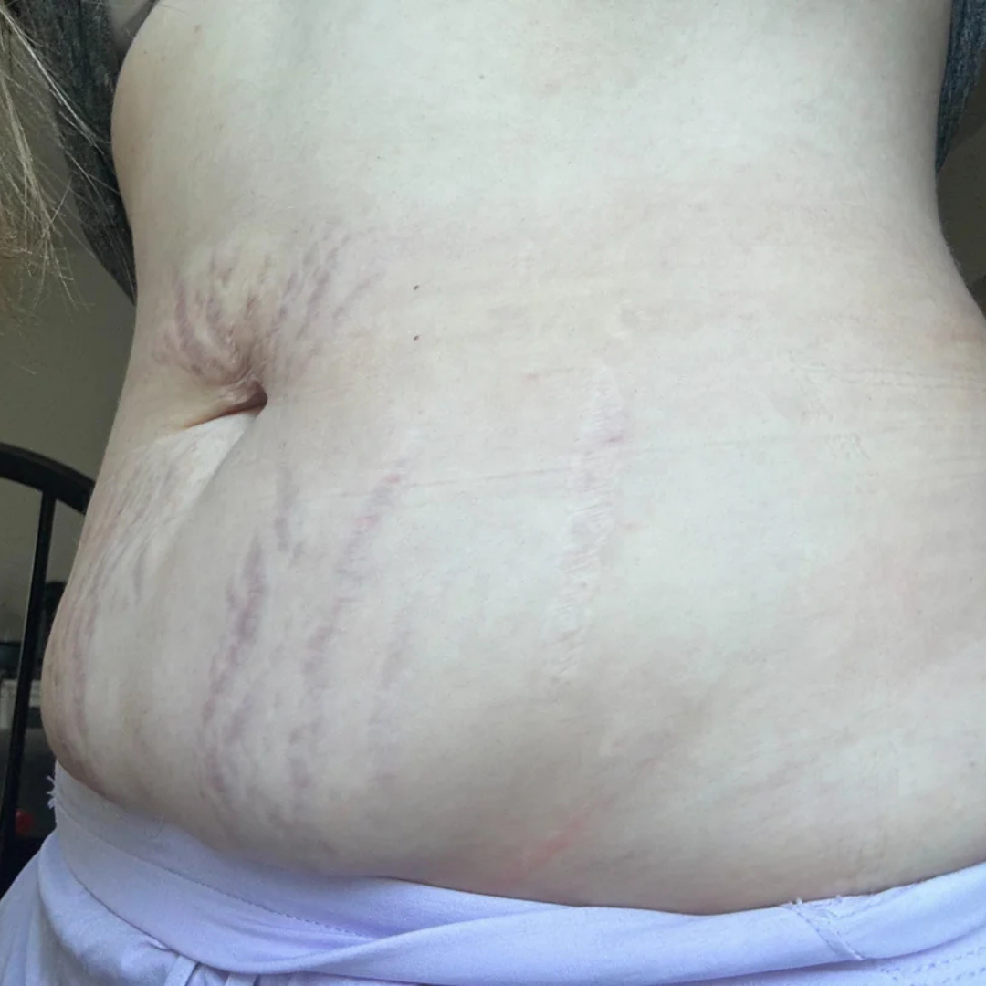 Emily Johnson Facebook ad: Weight Getting Harder to Lose Lately? Read This