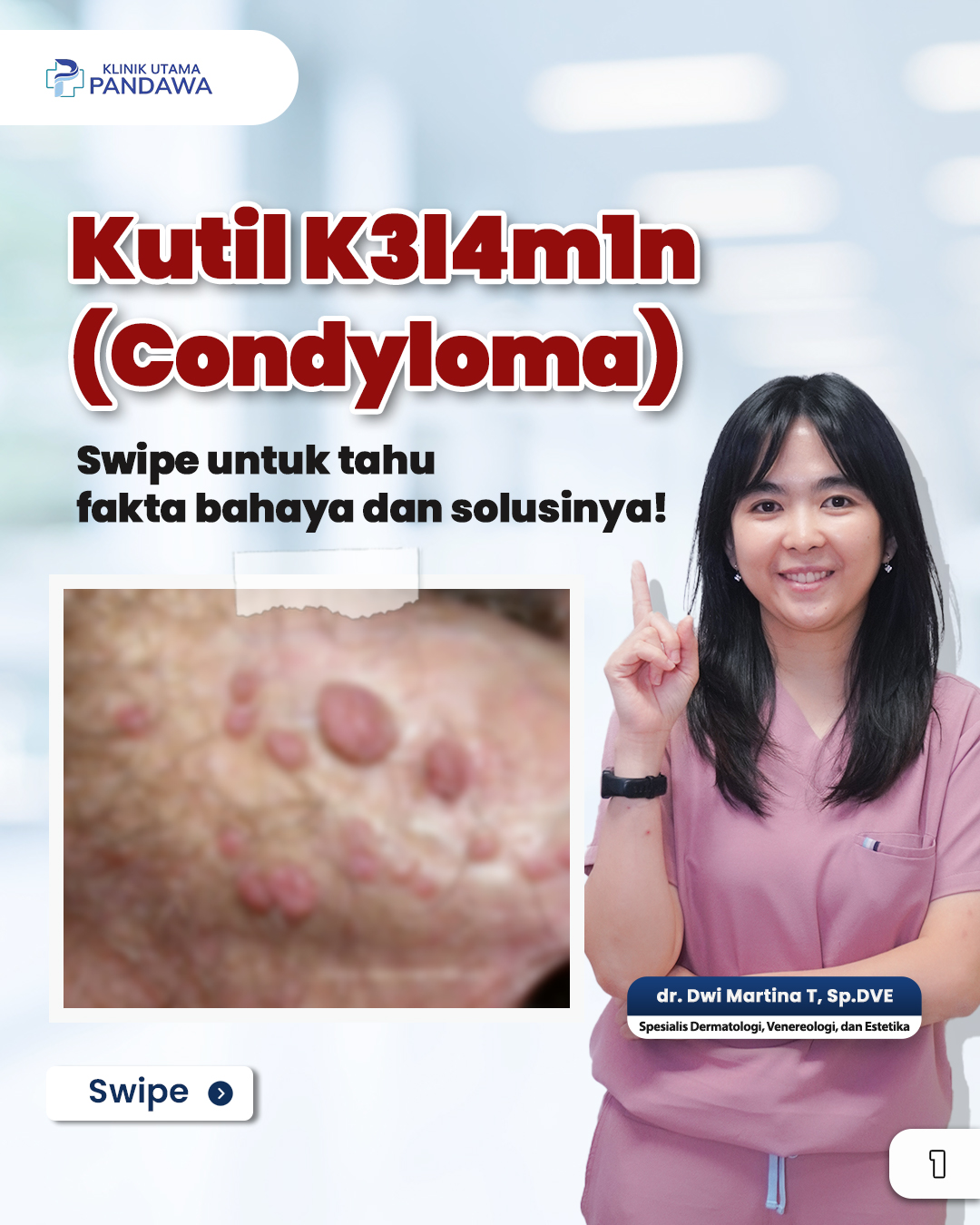 Klinik Utama Pandawa Jakarta Facebook ad: Banyak yang kira kutil kelamin bisa hilang sendiri.