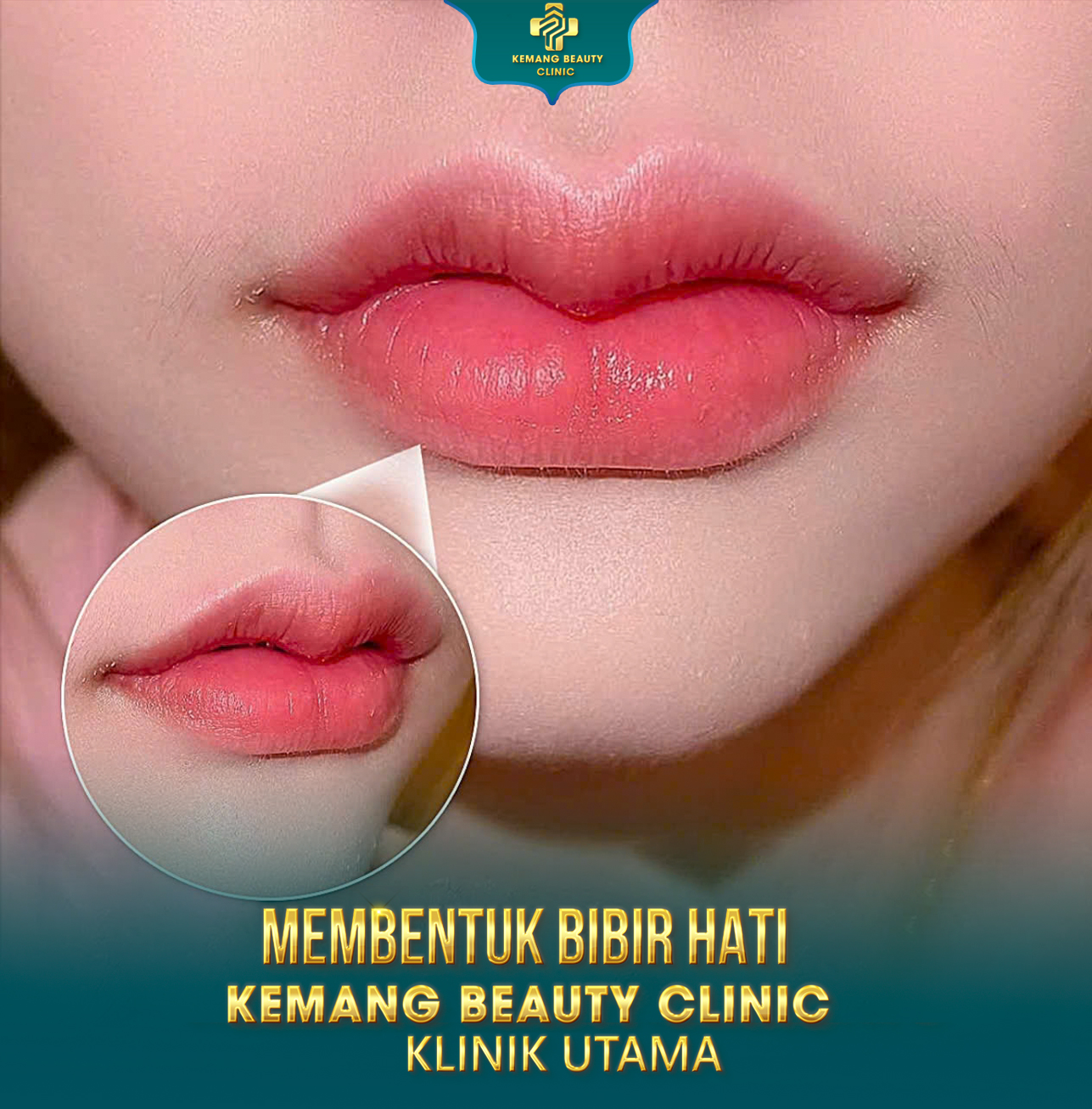 Kemang Beauty Clinic Facebook ad