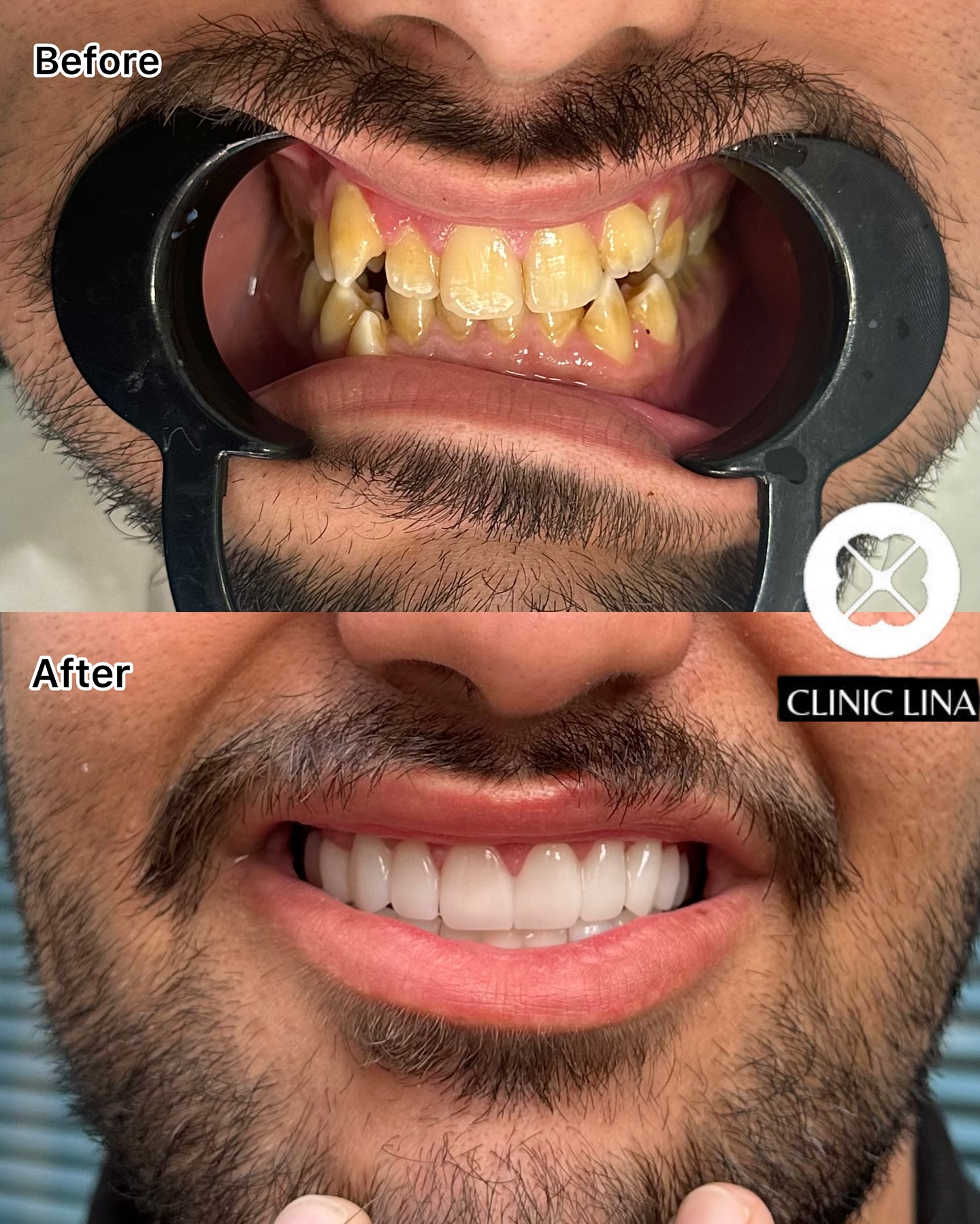 Clinic lina Facebook ad