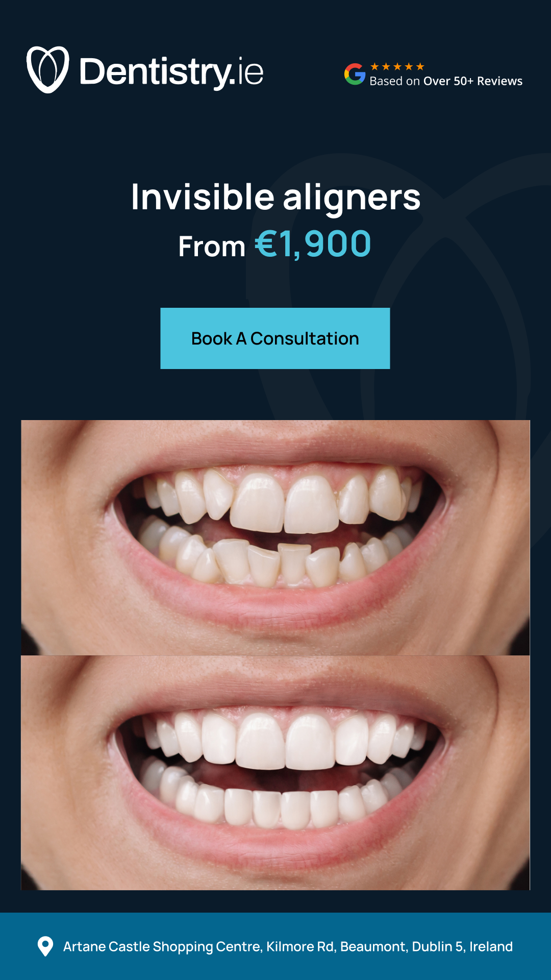 Artane Dental & Implant Clinic Facebook ad from Jun 2, 2026