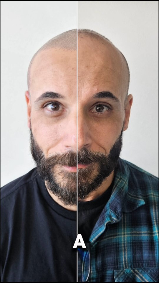 Micromax Micropigmentação Capilar Facebook ad: Cansado de usar Boné com vergonha da Calvície?