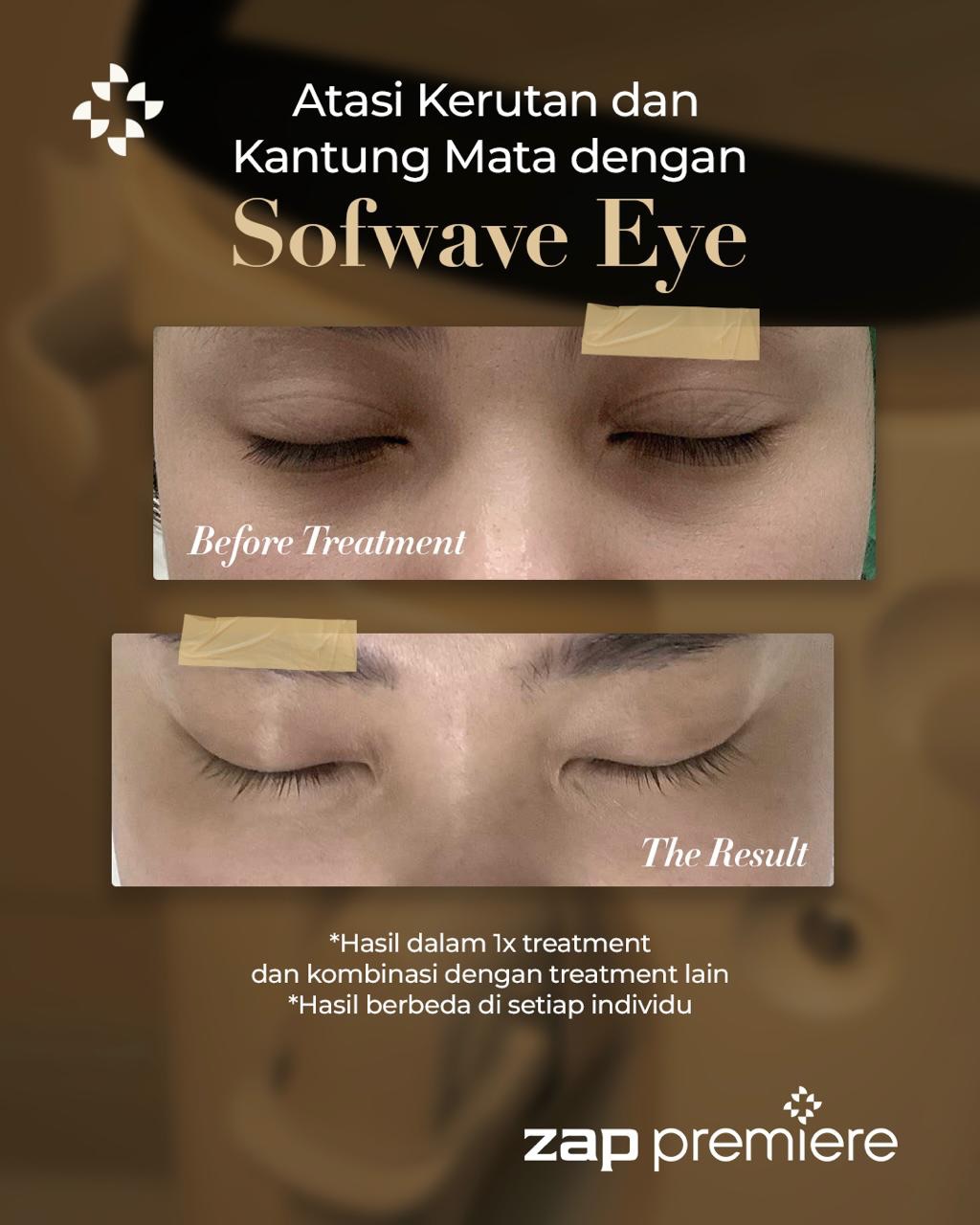 ZAP Premiere Indonesia Facebook ad