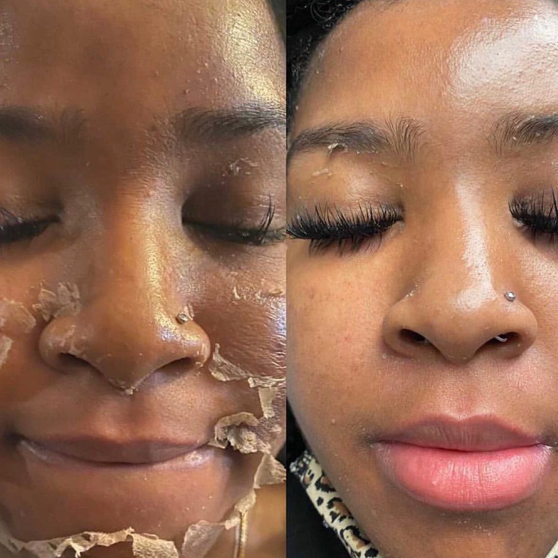 Thebeautyclinicstudio Facebook ad: Hyperpigmentation, dark spots, dull skin, freckles, fine…