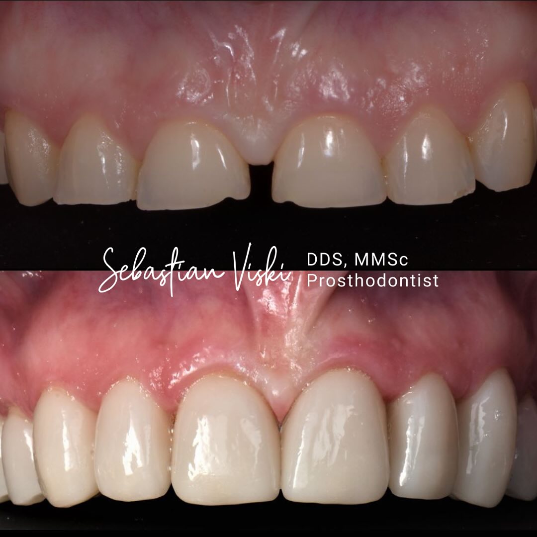Bonilla Dental Arts Facebook ad