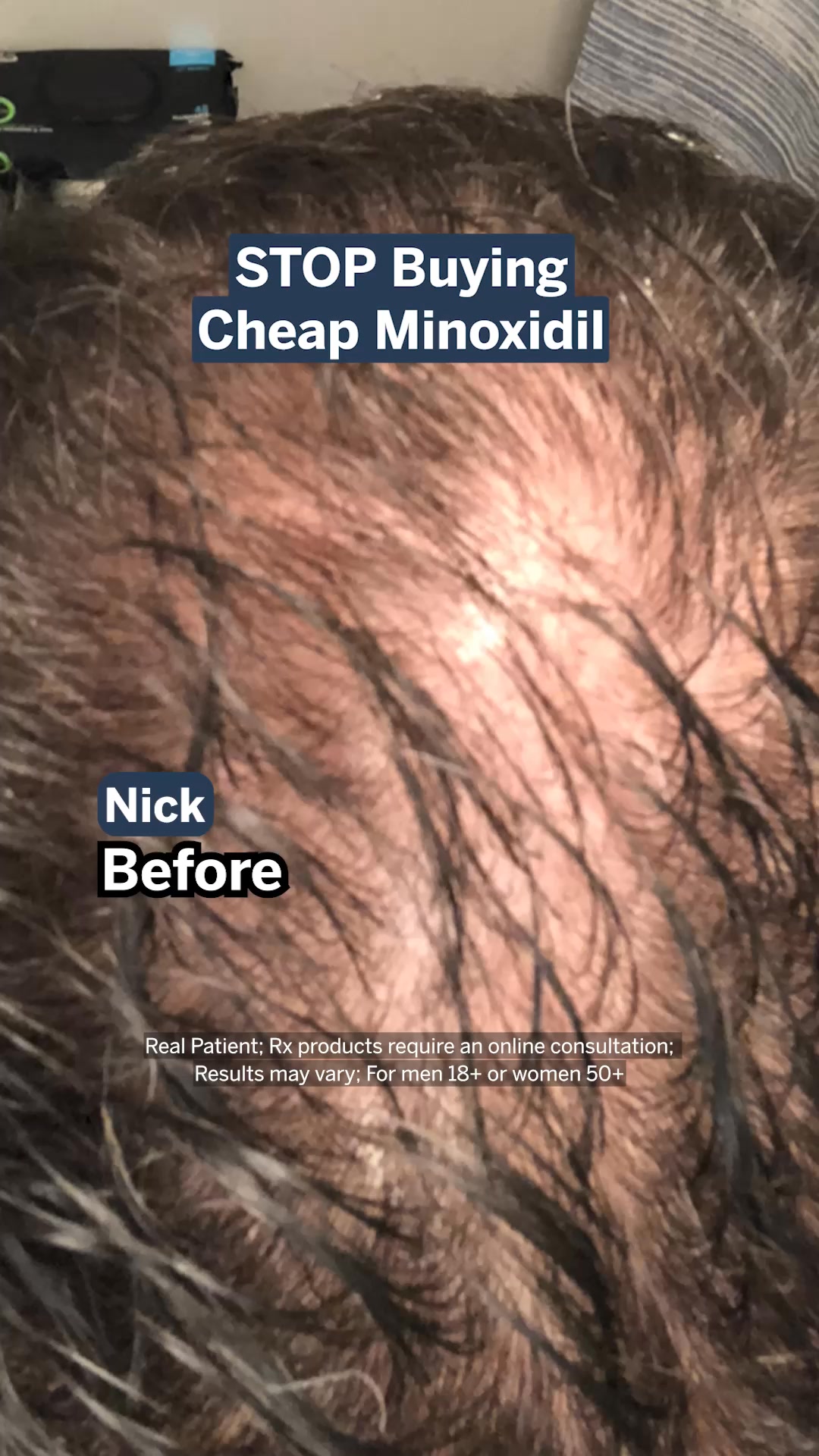 Happy Head Facebook ad: See results in 3 to 6 months
