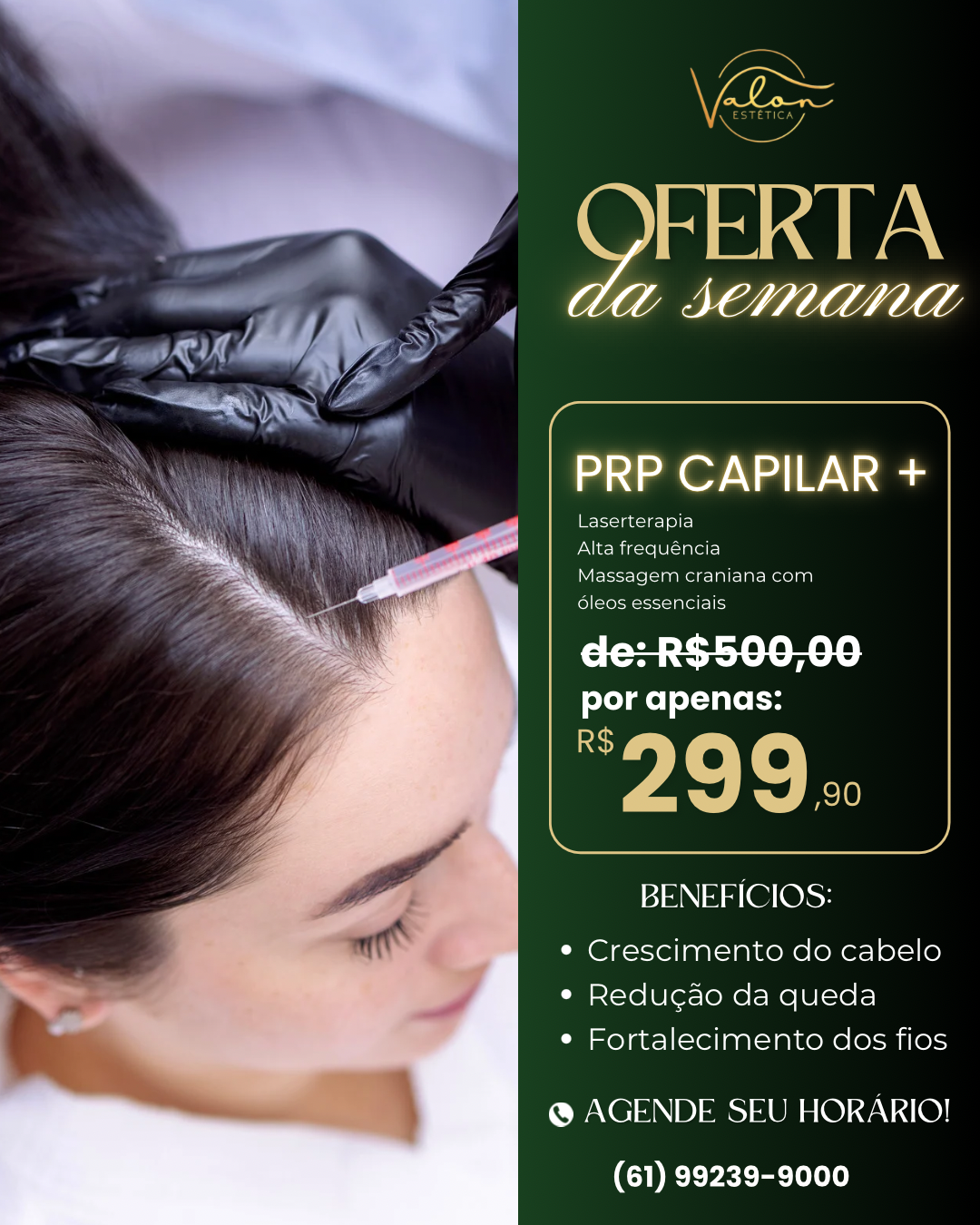 Valon estética 02 Facebook ad: Seu cabelo está caindo mais do que o…