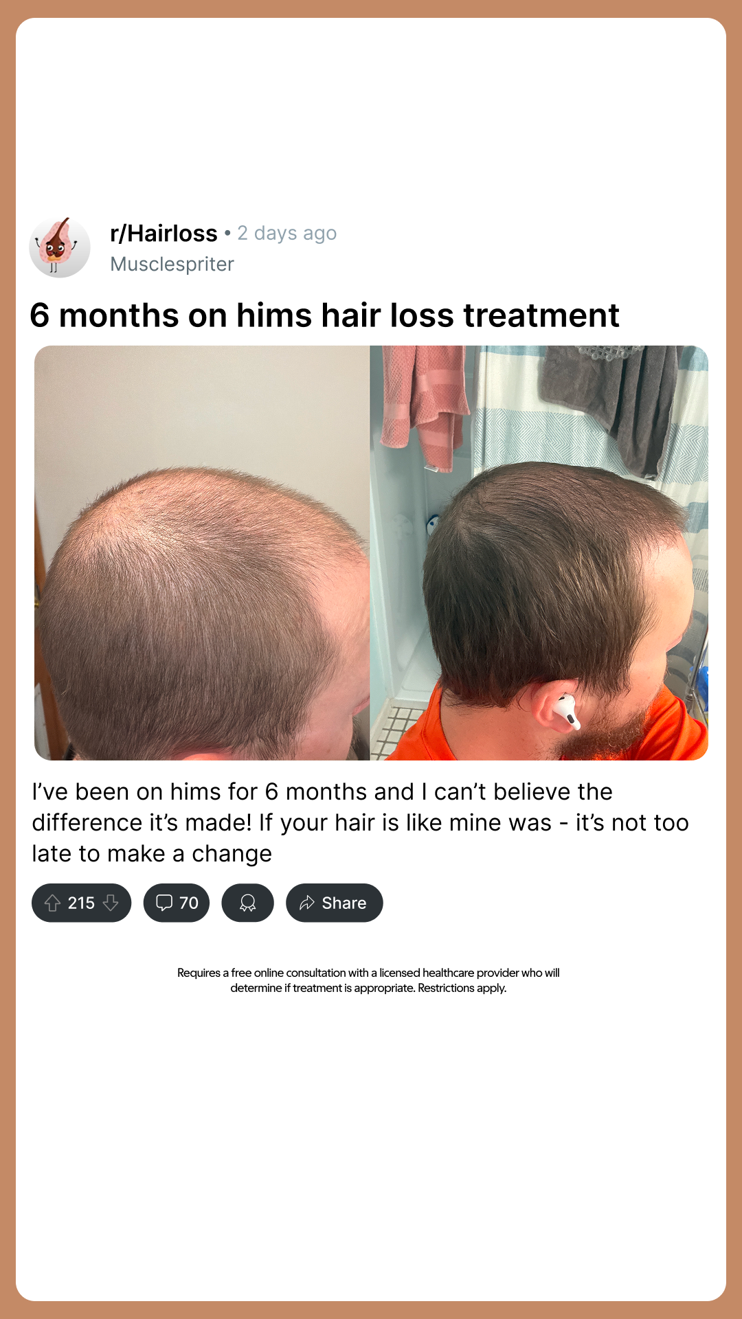 hims Facebook ad