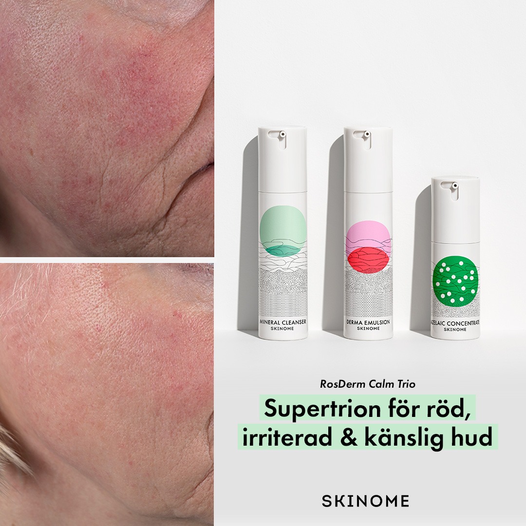 Skinome Facebook ad