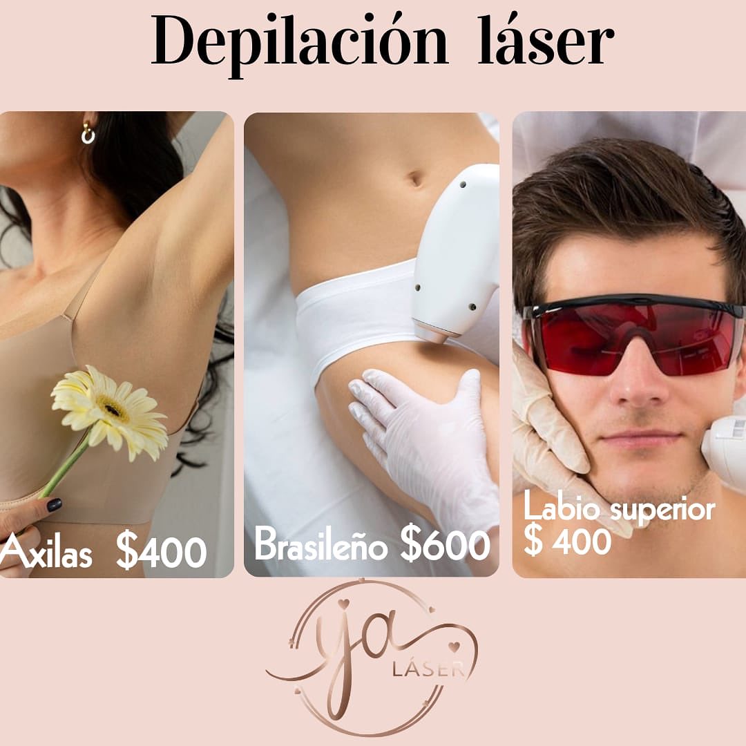 ya_depilacion_laser Facebook ad