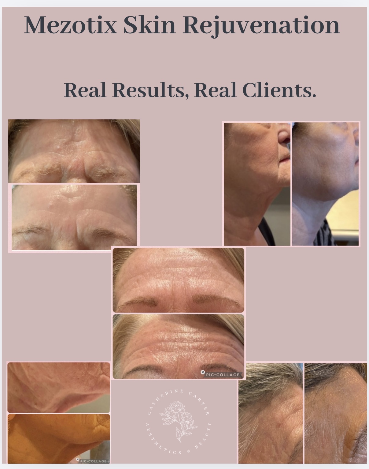 Catherine Carter Aesthetics & Beauty Facebook ad: Real Skin, Real Results, No filters