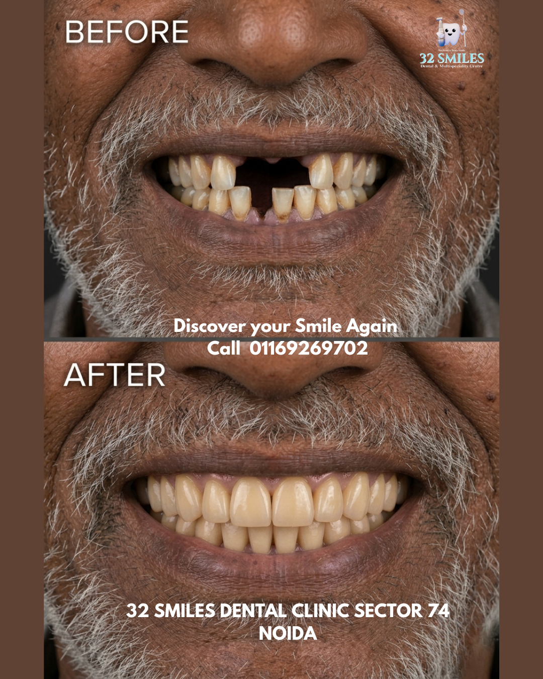 32 Smiles Dental Clinic Sector 74 Noida Facebook ad: Chat with us