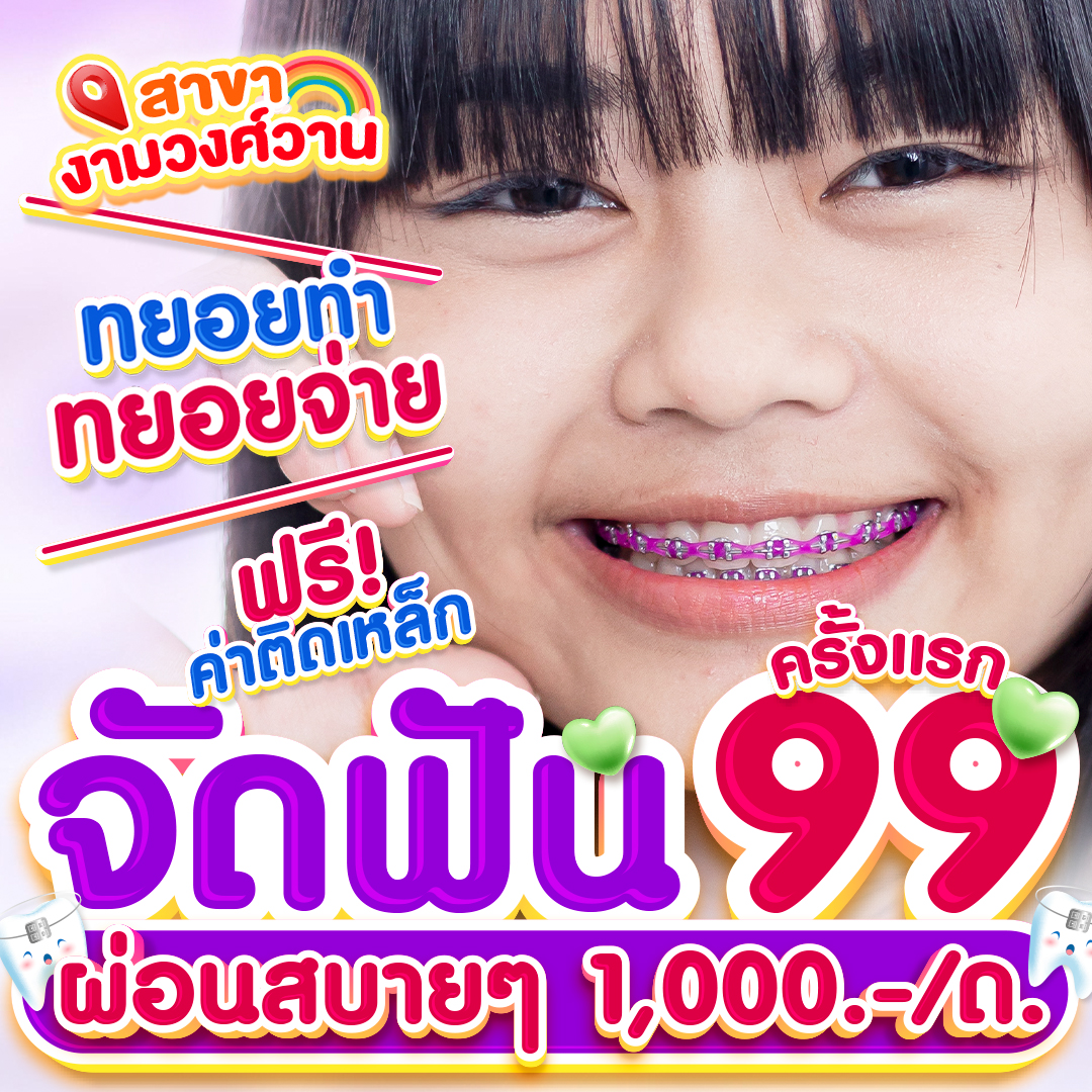 แหล่งรวมโปรโมชั่นจัดฟันดีสุด Facebook ad
