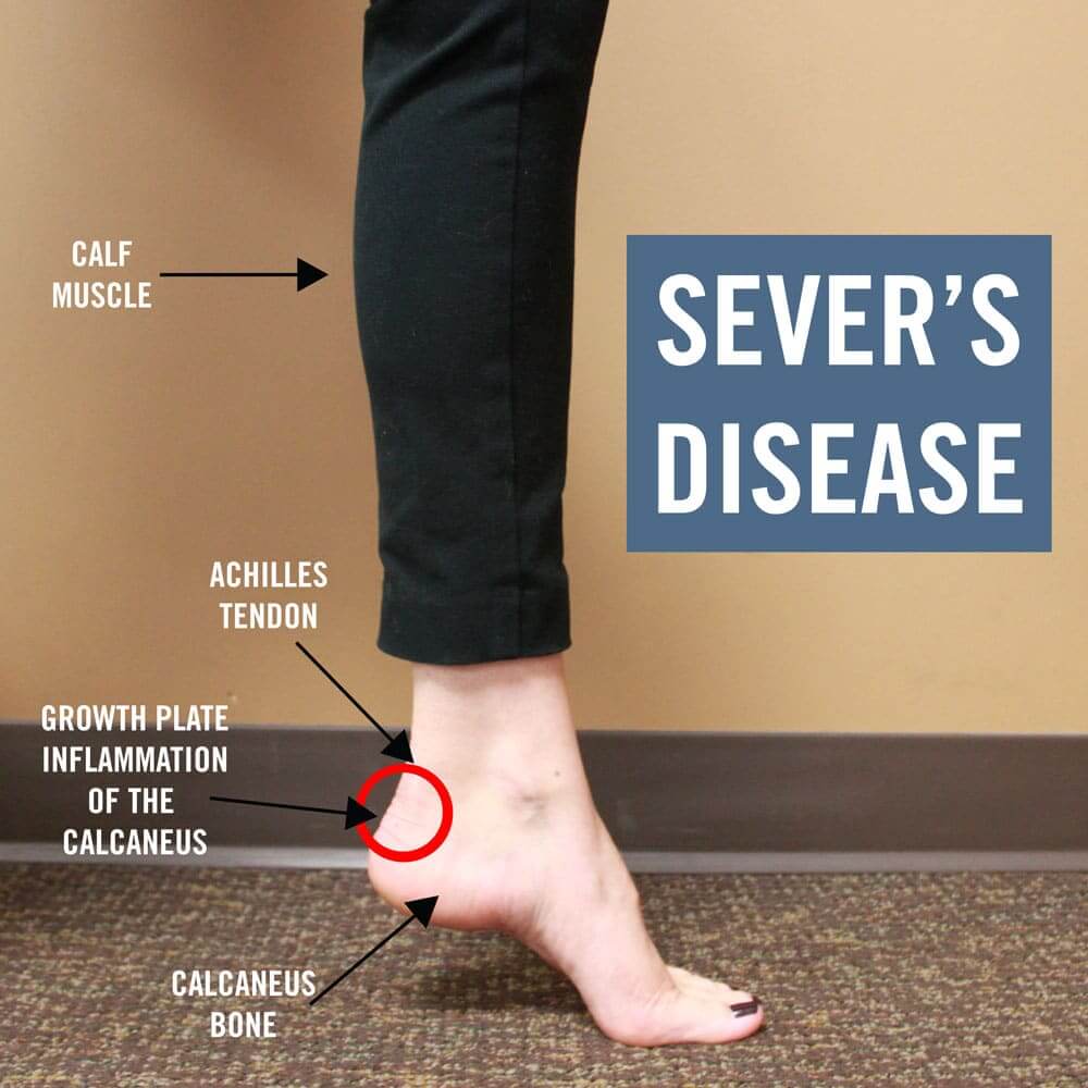 Foot & Leg Relief Center Facebook ad