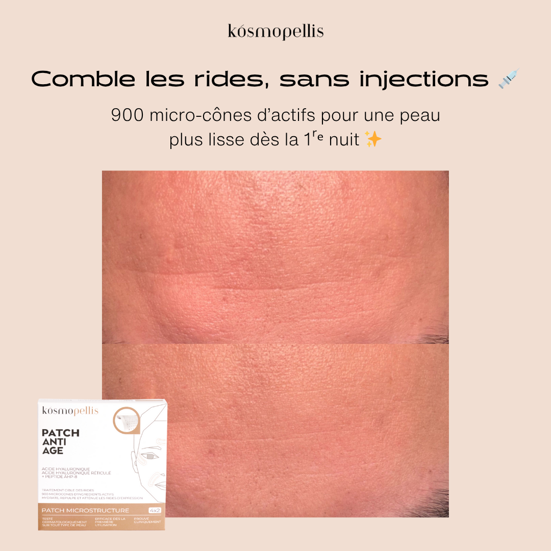Kósmopellis Facebook ad from Nov 12, 2025