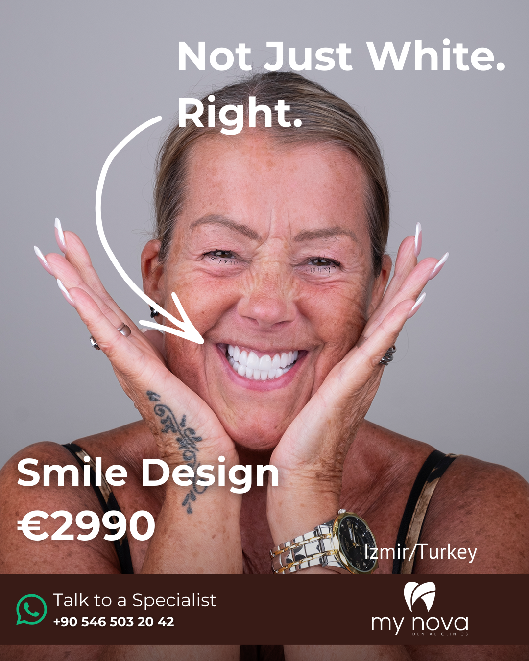 My Nova Dental Clinics Facebook ad