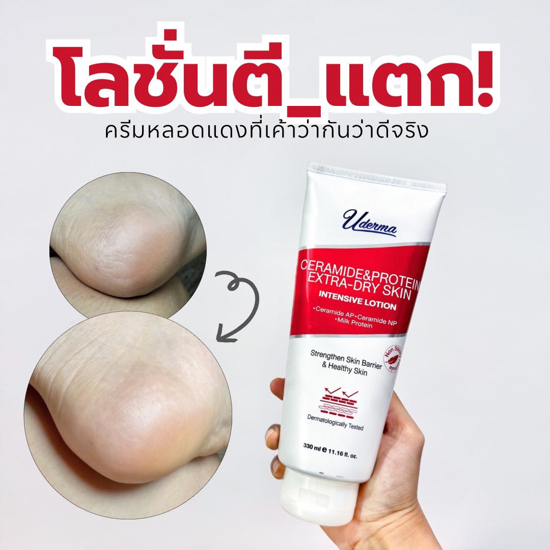 งอมแงม Facebook ad: รีวิว! โลชั่นตีนแตก…ที่ช่วยชีวิตเท้าแห้งได้ปังสุดๆ!