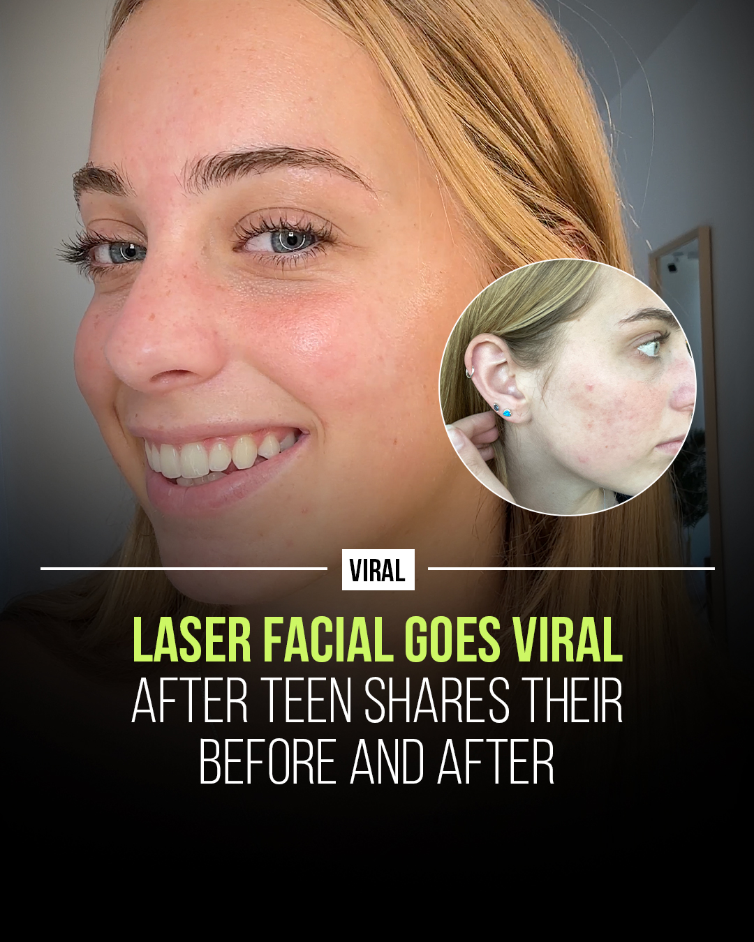 Skin Laundry Facebook ad