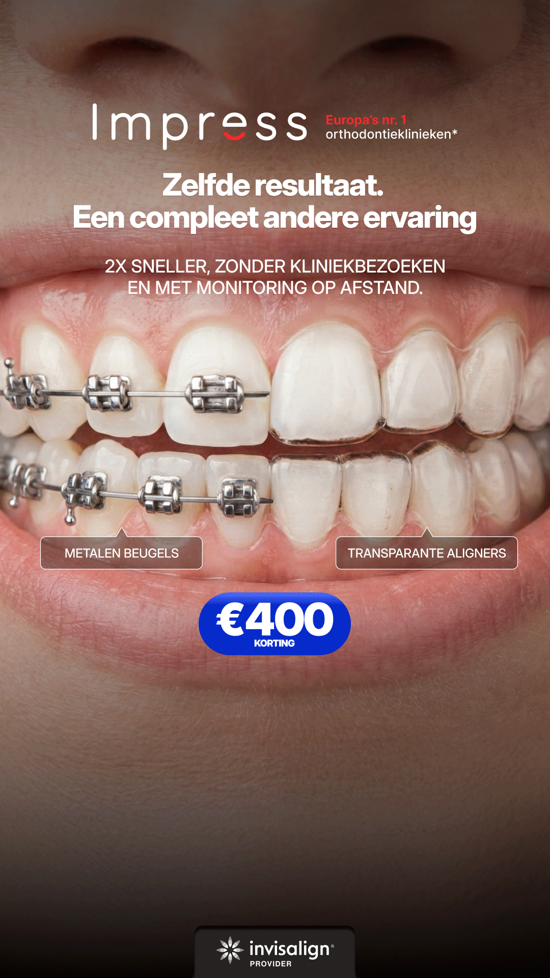Impress Nederland Aligners Facebook ad
