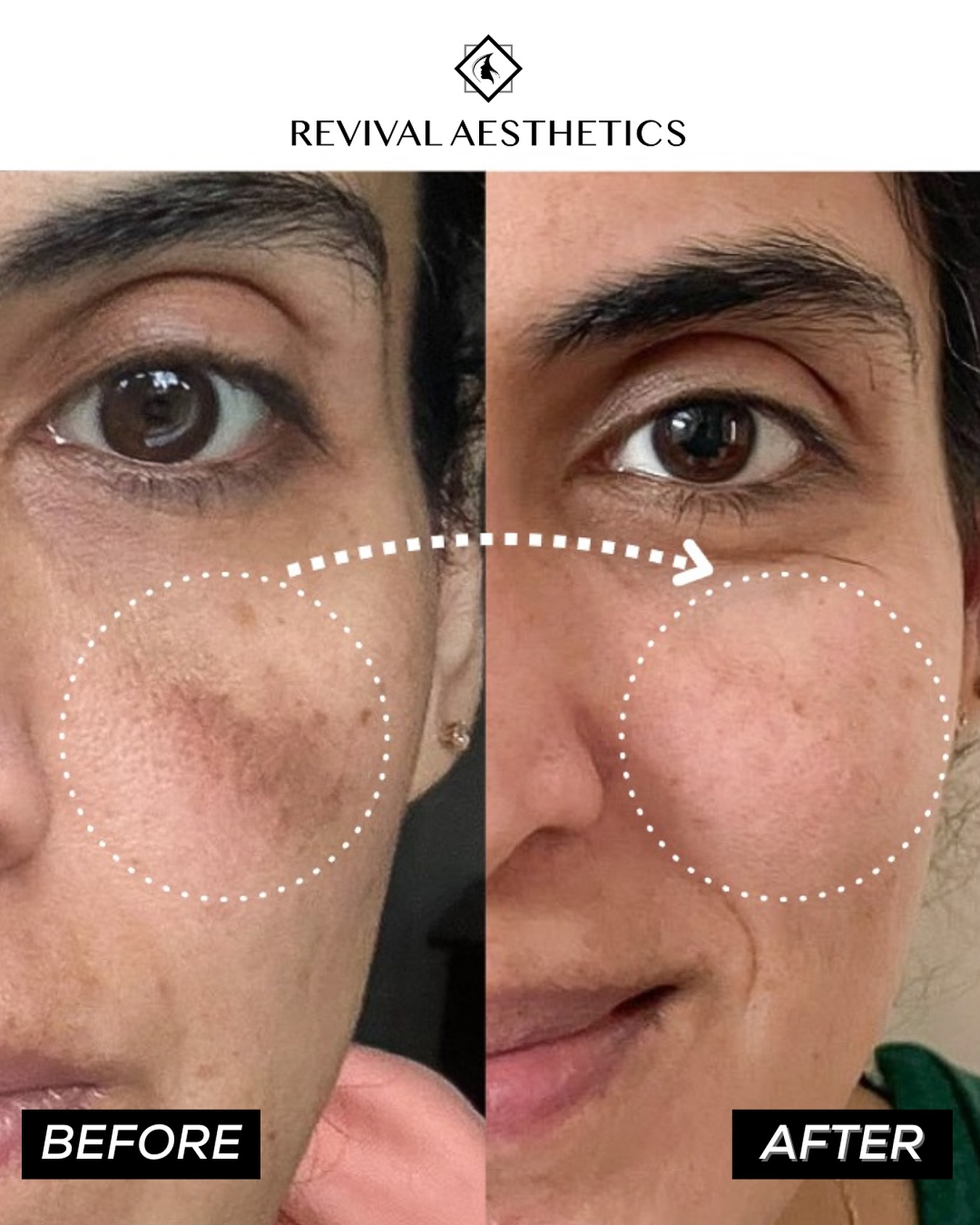 Revival Aesthetics Facebook ad