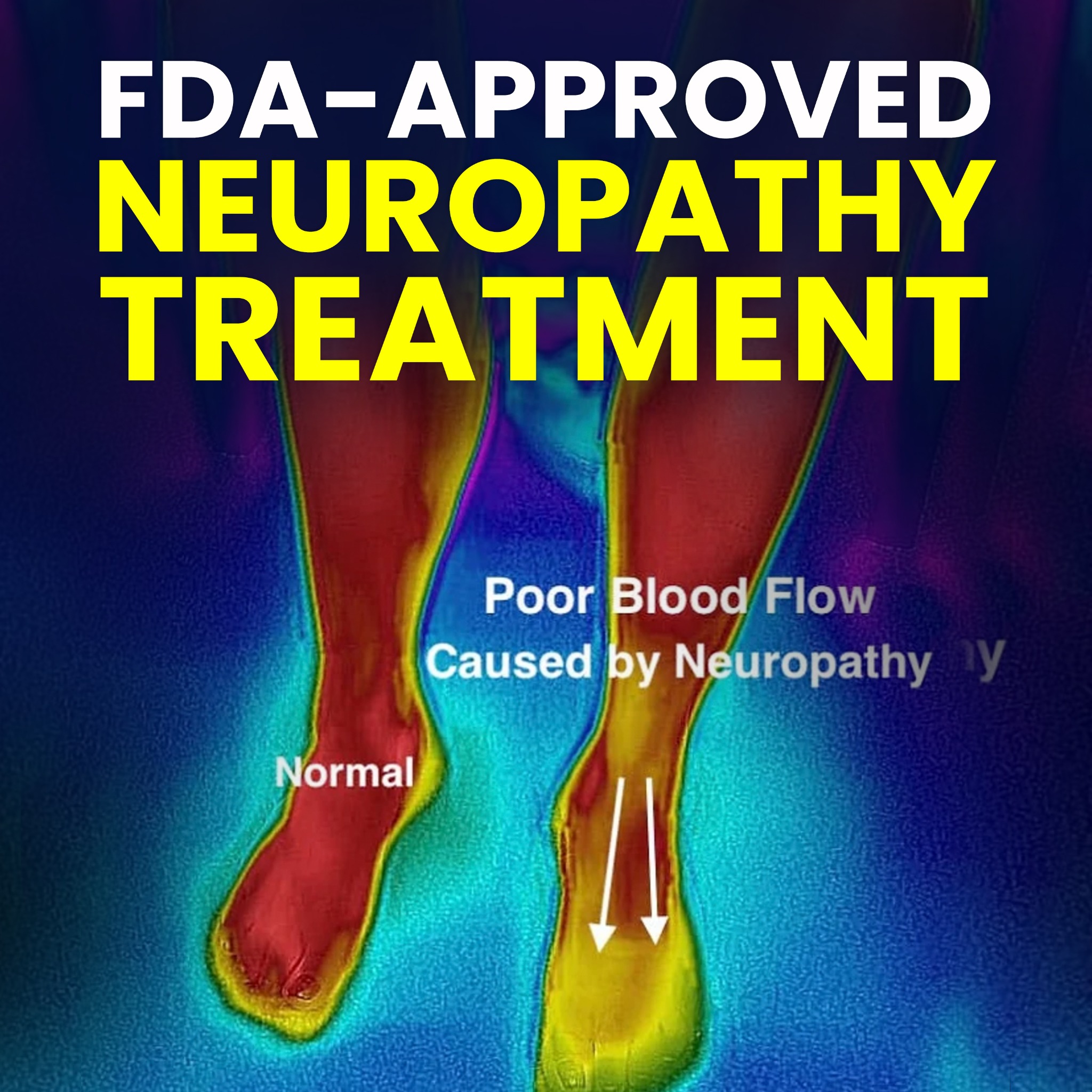 Tri-State Neuropathy Centers Facebook ad: NEW: Breakthrough Neuropathy Treatment