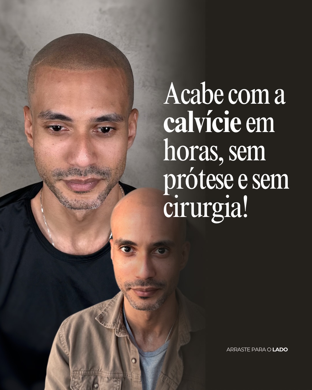 Geisa Silva - Micropigmentação Capilar Facebook ad: Você é do Rio de Janeiro e está…