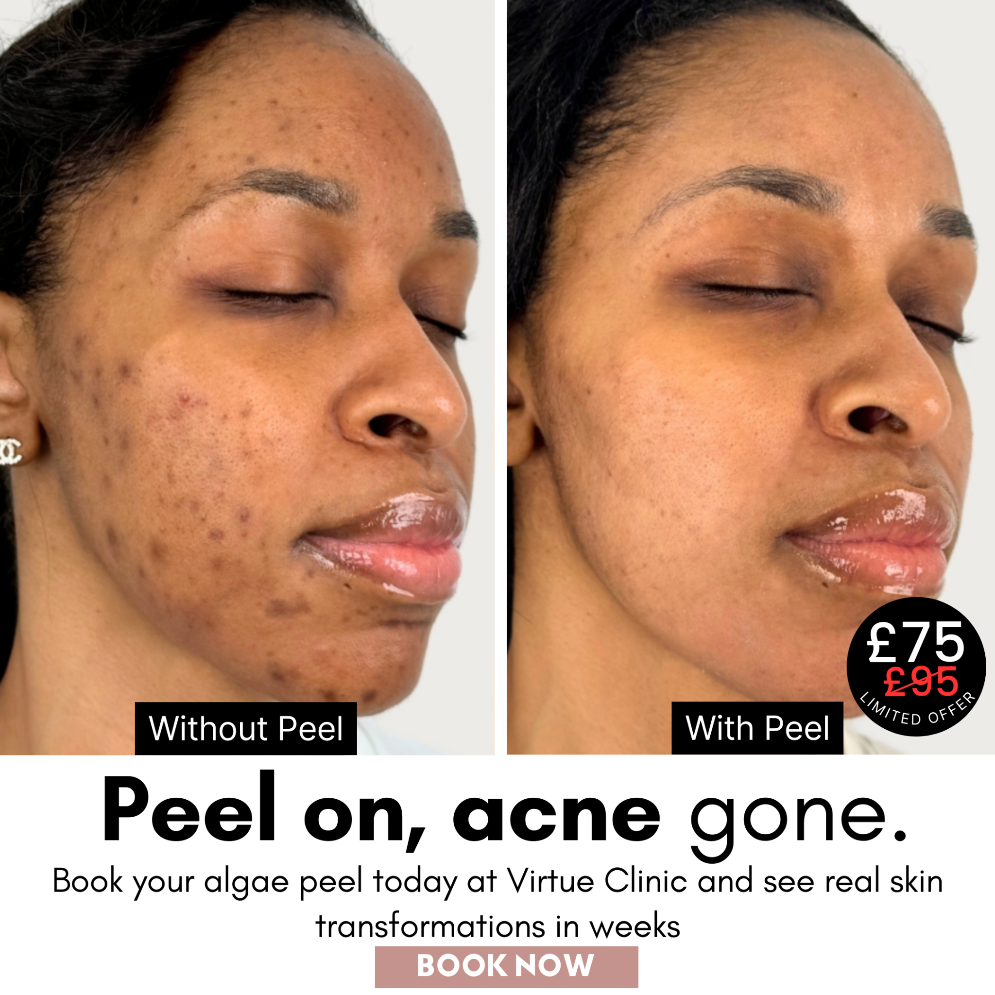 Virtue Aesthetic Treatments Facebook ad