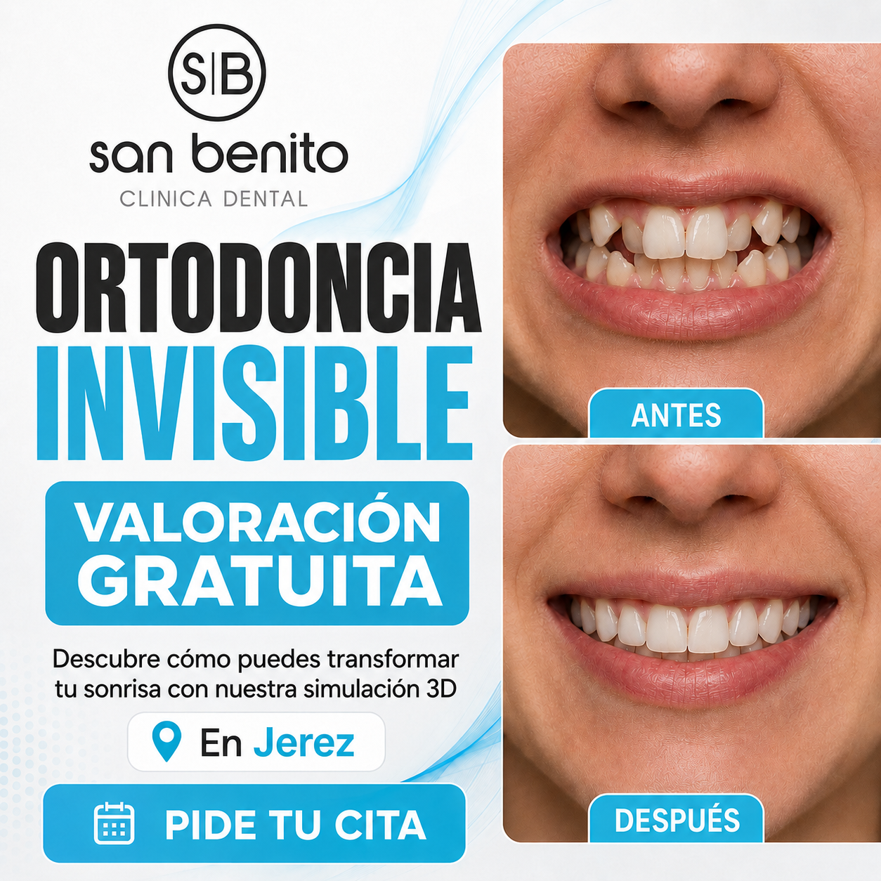 Clinica Dental San Benito Facebook ad: Valoración de Ortodoncia GRATIS en Jerez