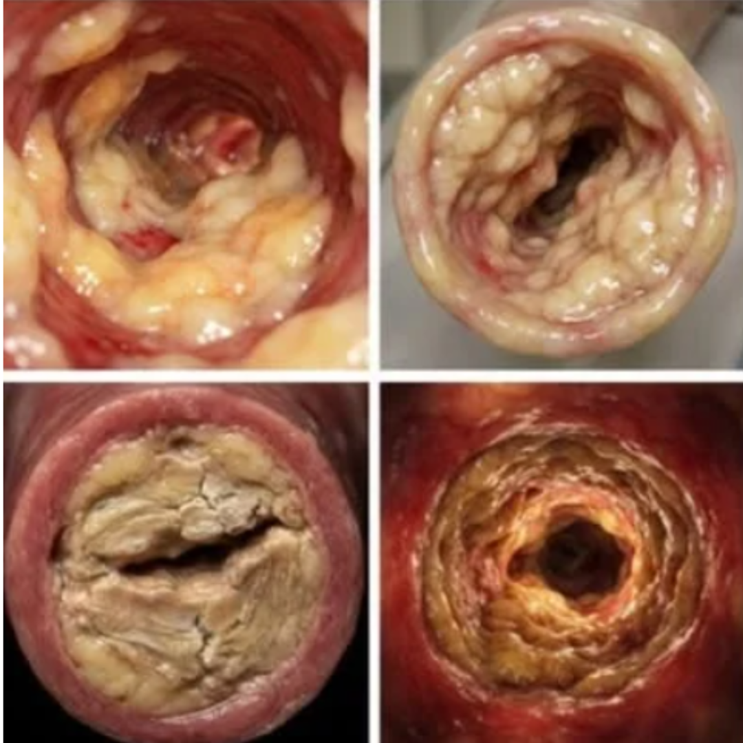 Dr. Michael Carter Facebook ad