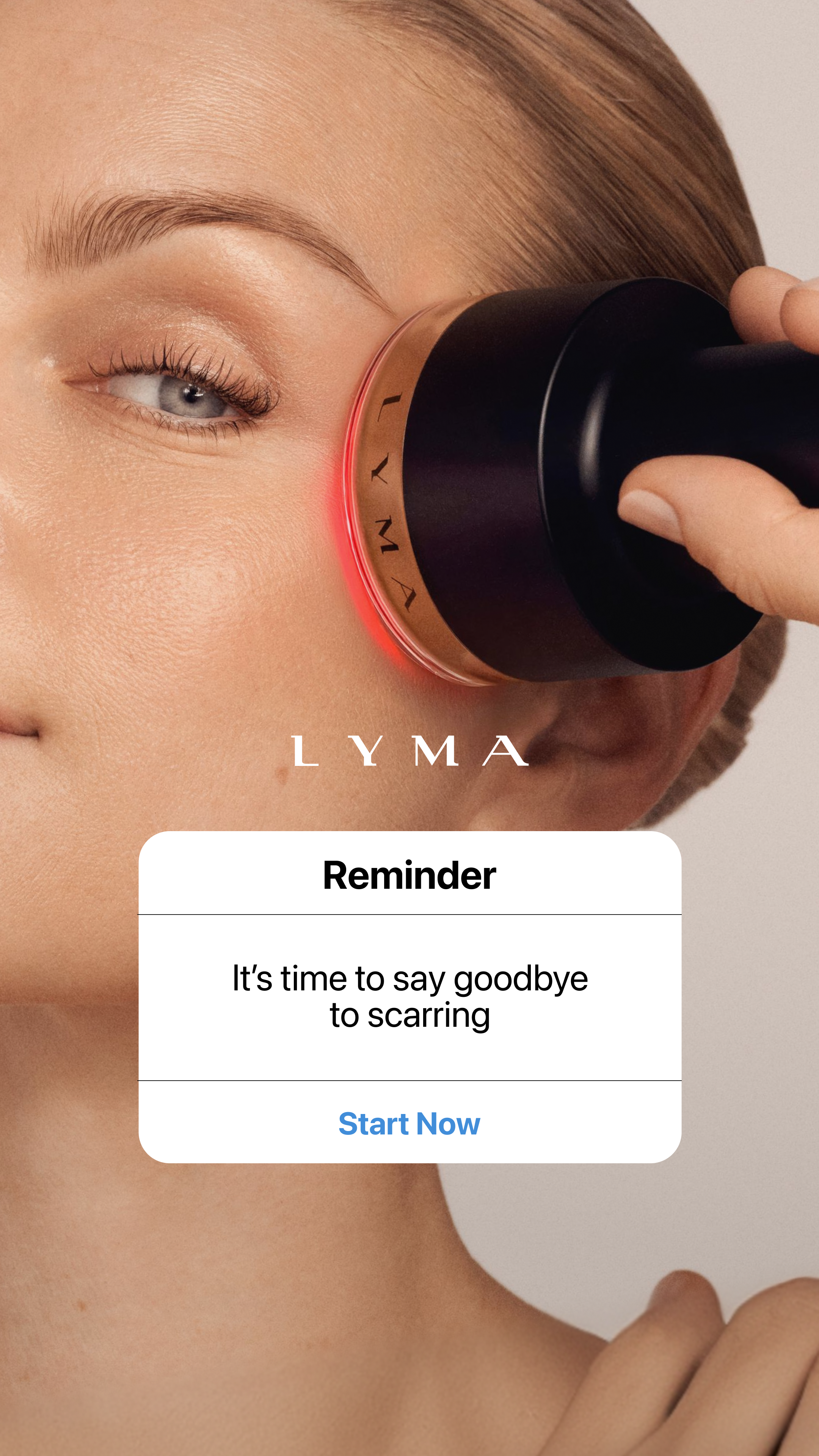 LYMA Facebook ad