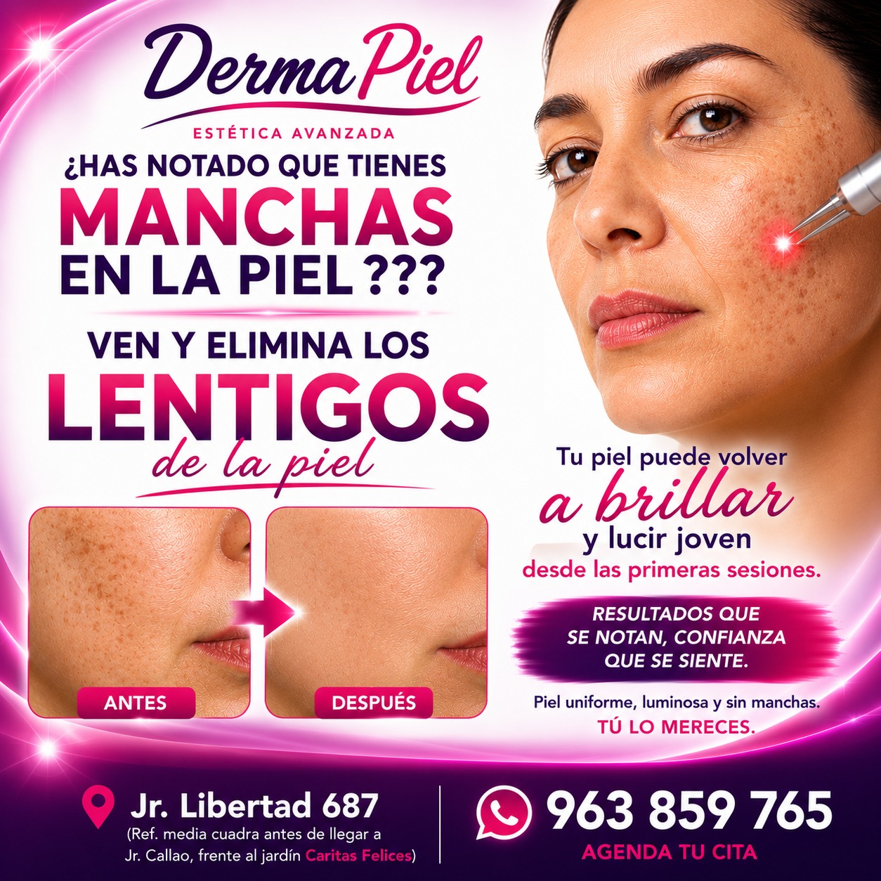 𝐃𝐄𝐑𝐌𝐀𝐏𝐈𝐄𝐋 𝐄𝐒𝐓𝐄́𝐓𝐈𝐂𝐀 Facebook ad: LÁSER CO₂ FRACCIONADO VISÍTANOS en LIBERTAD 687 (Ref.