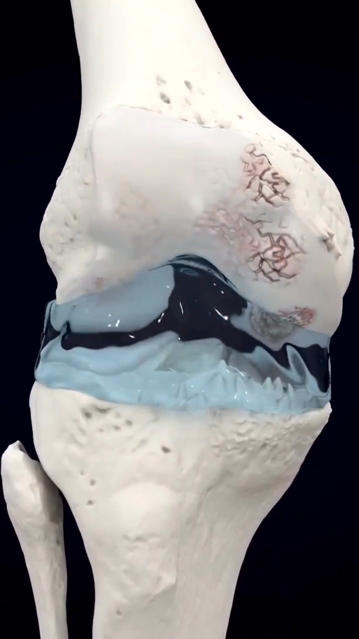 North Cobb Spine and Nerve Institute Facebook ad: Before You Consider Knee Surgery, Learn Your Options