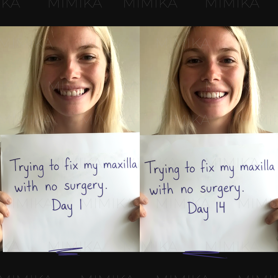 Mimika - Face Yoga Exercises Facebook ad