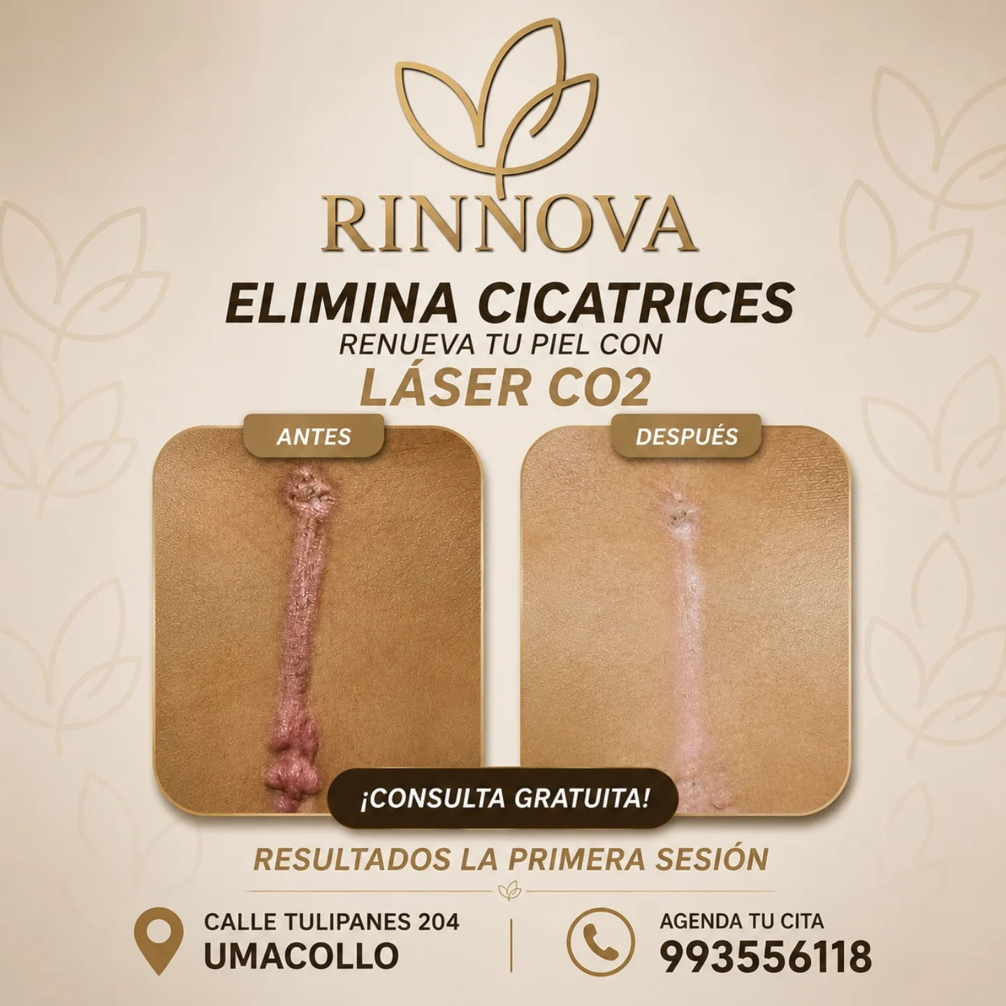 Rinnova Facebook ad: RENUEVA TU PIEL Y DEVUÉLVELE SU BELLEZA