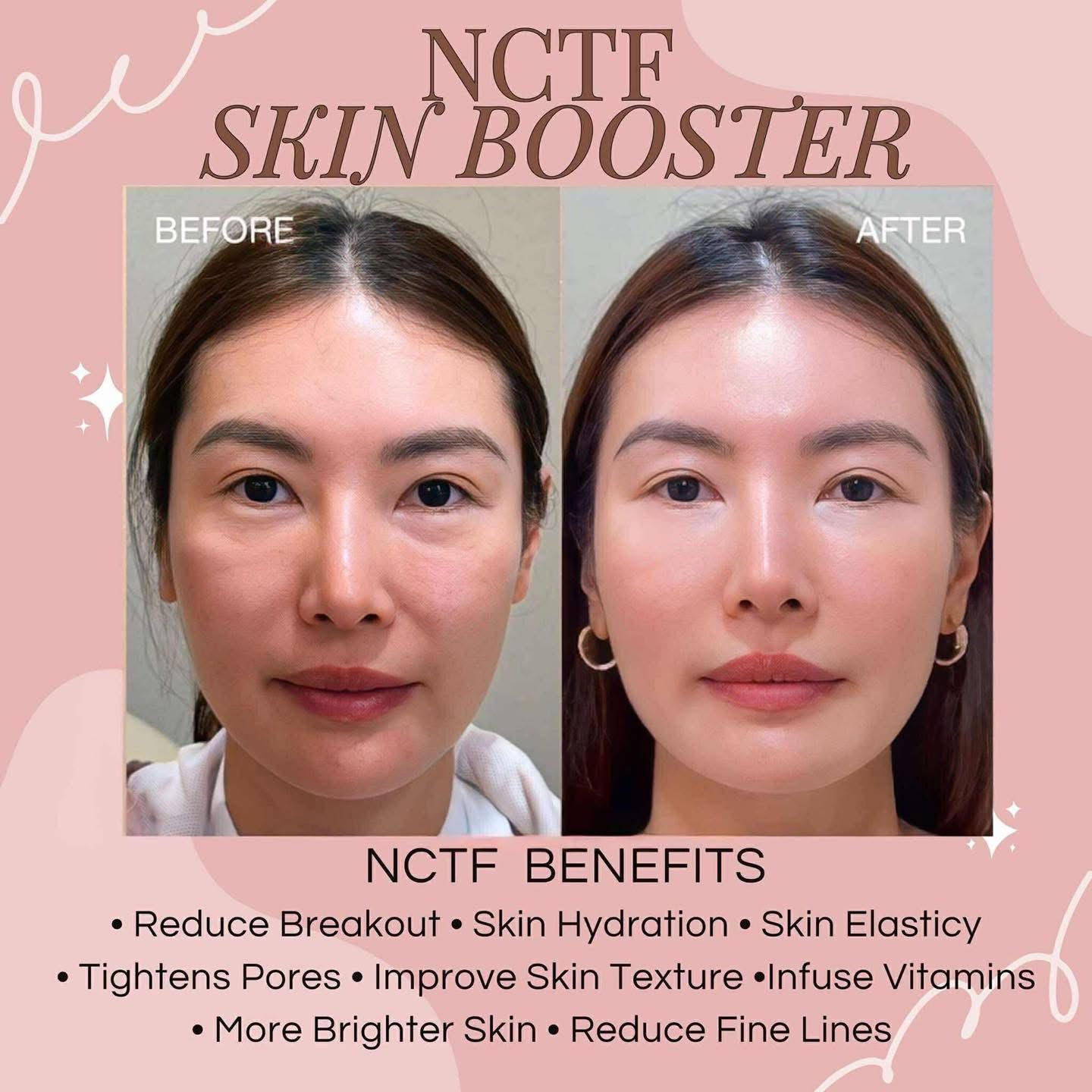 Skincerity Aesthetic PH Facebook ad: Glow up with Skincerity Aesthetic Clinic