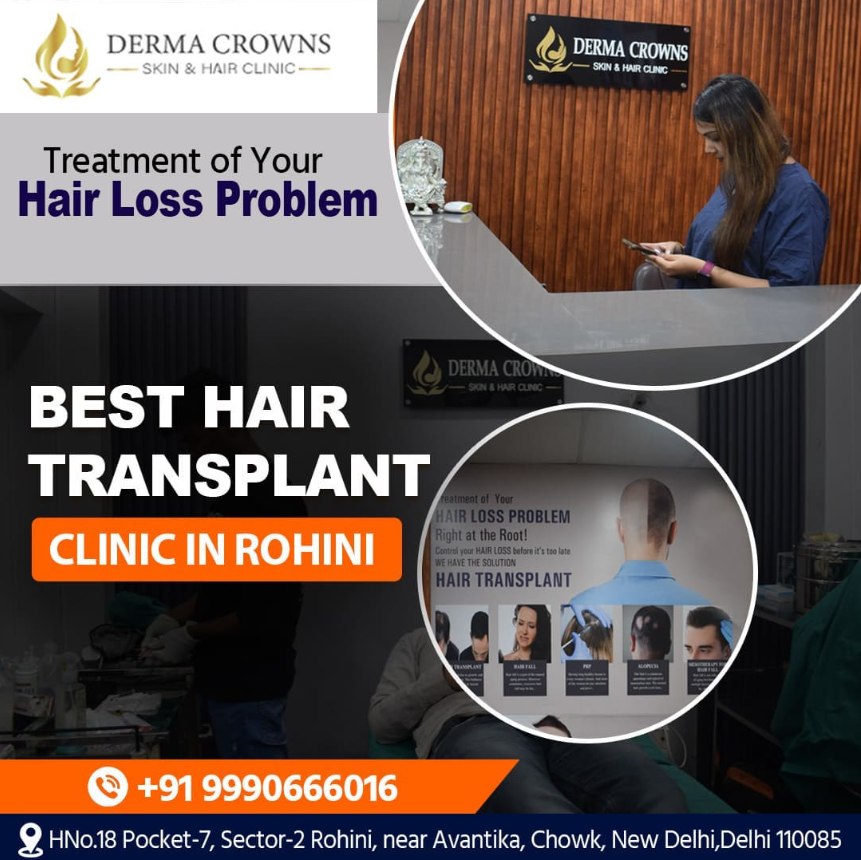DermaCrown Facebook ad: Rohini's No.1 Hair and Skin Clinic.
