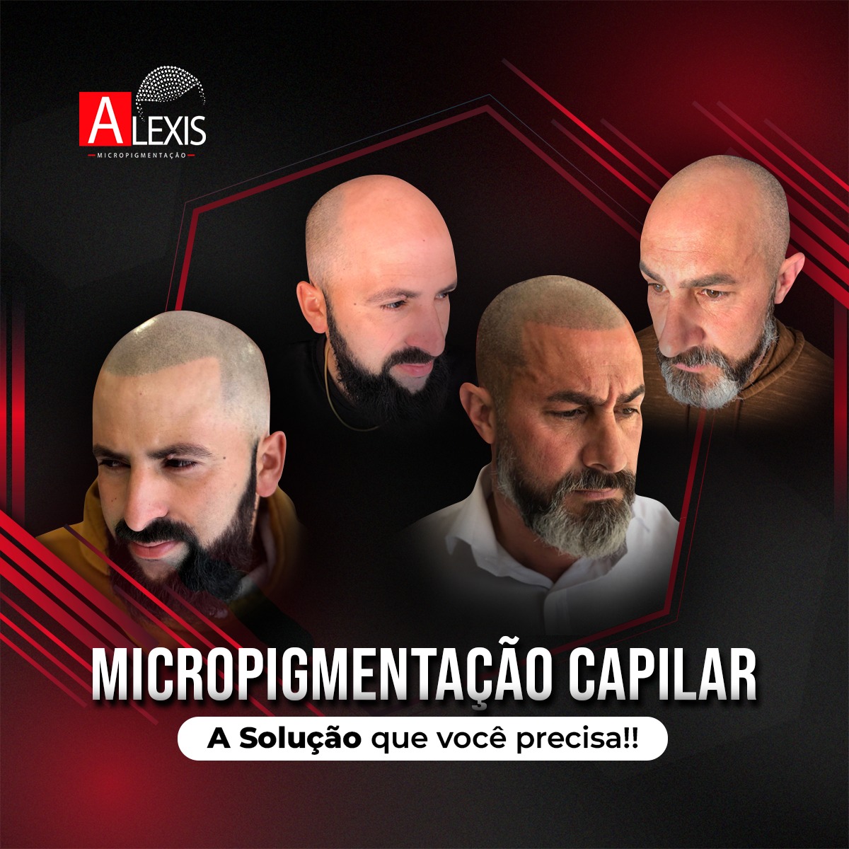 Alexis Micropigmentação Capilar Facebook ad: Que tal você com um visual novo e…