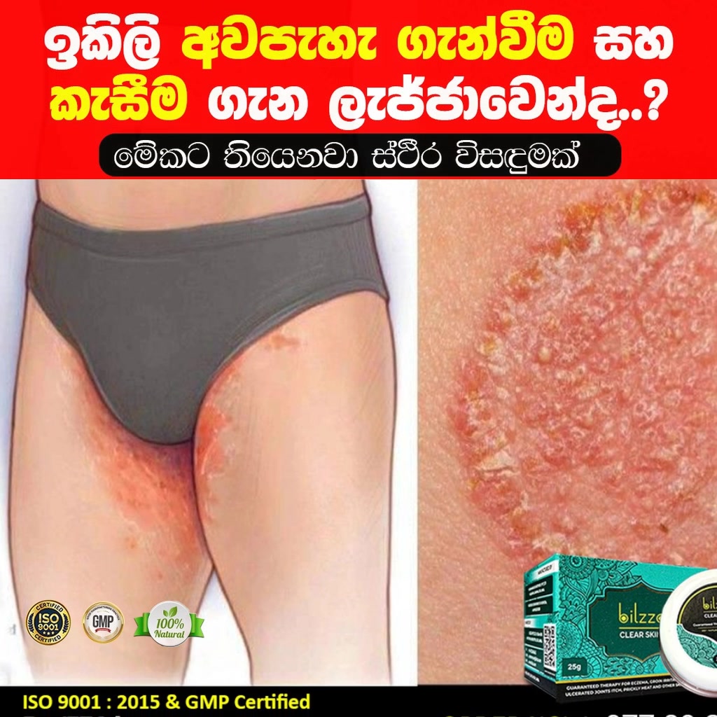 Clear Skin Facebook ad